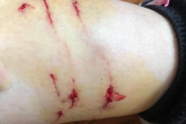 女人梦见猫扑向自己咬