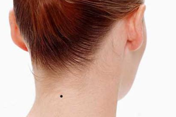 风水上女生脖子后面有痣代表什么啊 风水上女生脖子后面有痣代表什么啊