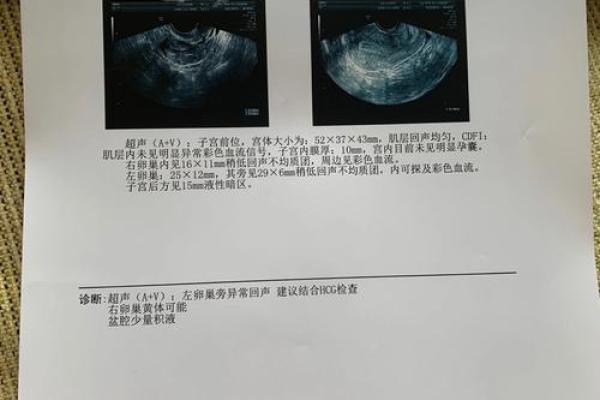 算命的算出宫外孕 算命的算出宫外孕