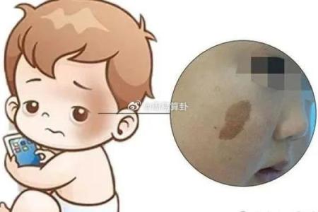 胎记算命的方法