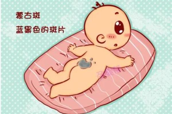 脸上胎记算命看出命运 脸上胎记算命看出命运