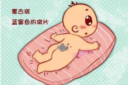 脸上胎记算命看出命运