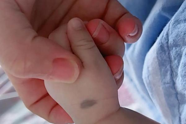 手上胎记算命图解