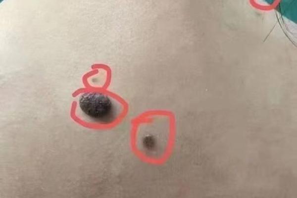 女人背部痣相图解算命 女人背部痣相图解算命