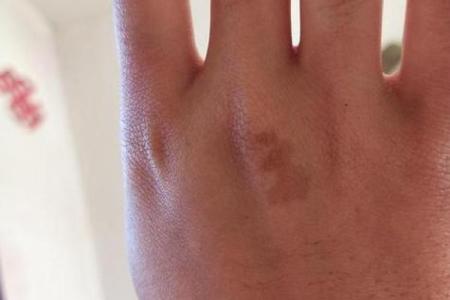 胎记算命图,后背胎记全面图解