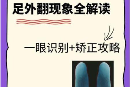 纠正外八字脚