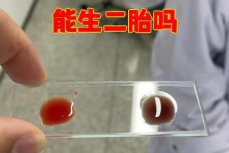 ab血型通常长得较漂亮