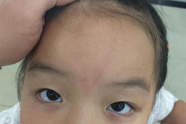 胎记位置算命看运势 胎记位置算命看运势