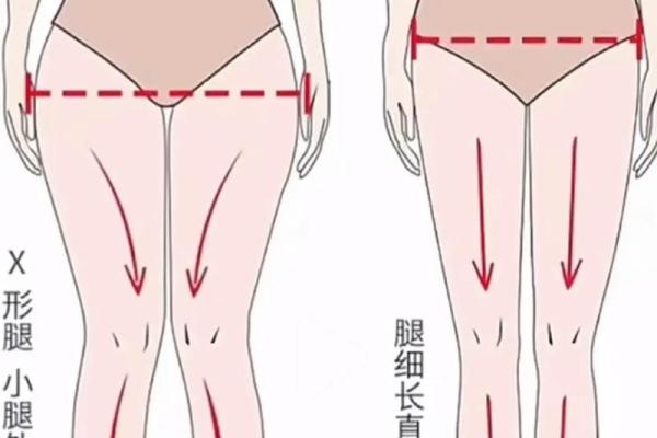 八字型腿 八字型腿