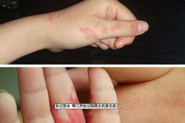 手臂上的胎记算命图解