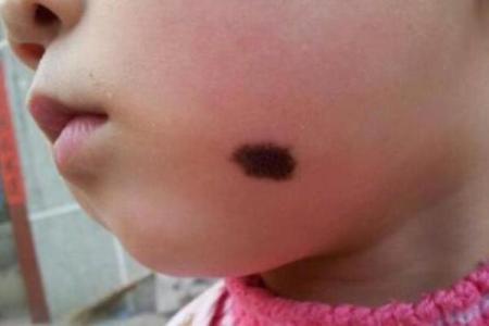 手臂上的胎记算命图解