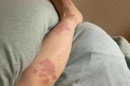 腿上不同位置的胎记算命