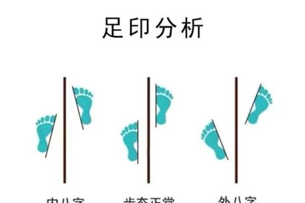 2岁八字脚 2岁八字脚