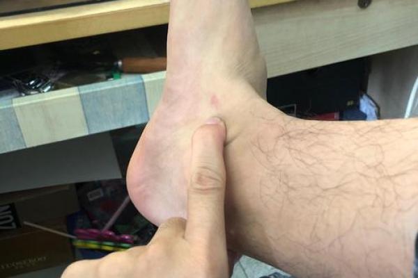 风水学上胎记中的有说明什么 风水学上胎记中的有说明什么