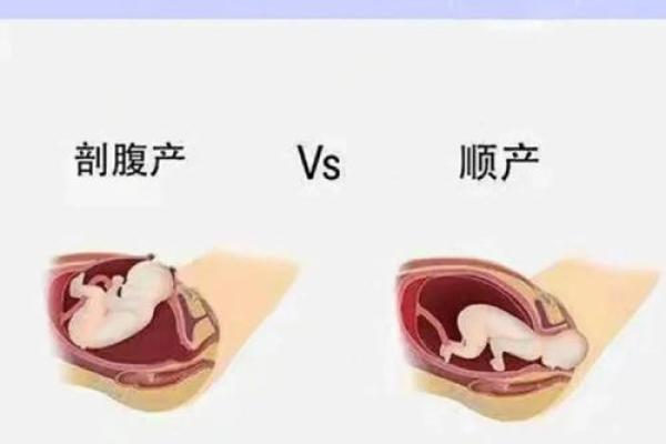 剖腹产八字不准实例