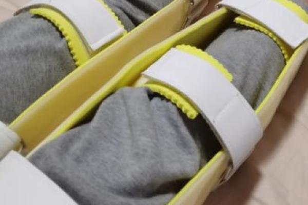 如何矫正外八字