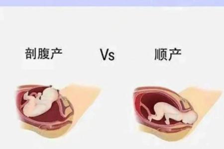 剖腹产八字不准实例