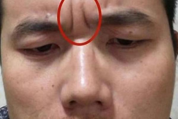 印堂八字纹的男人爱老婆吗 印堂八字纹的男人爱老婆吗