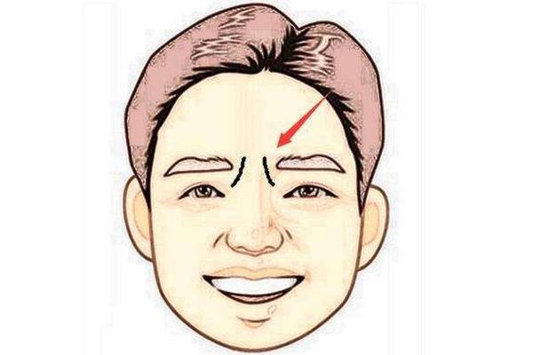 印堂八字纹的男人财运好吗