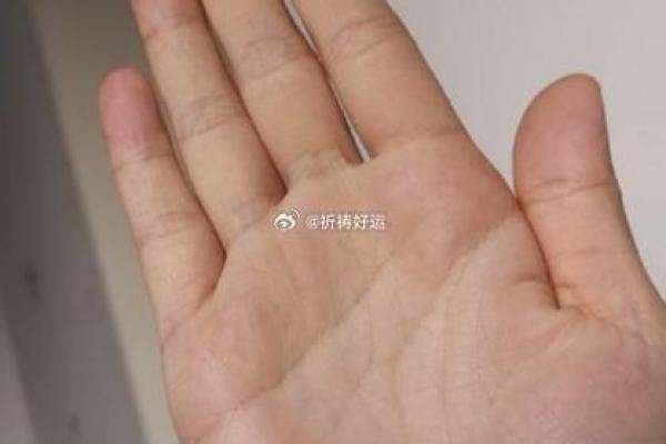 算命的说，手腕上有这样的纹路，一定会破财！