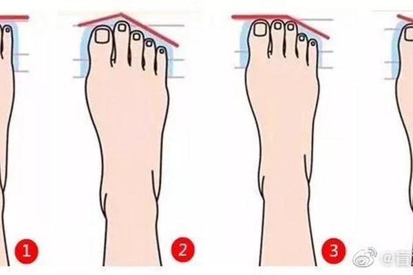 八字脚是什么 八字脚是什么