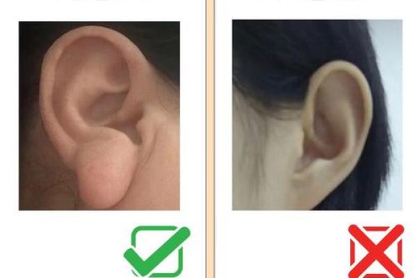 风水面相耳朵垂大的人代表有福气吗