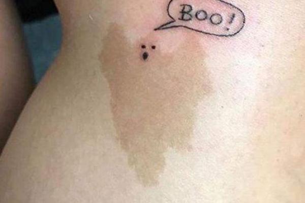 胎记算命全解 胎记算命全解