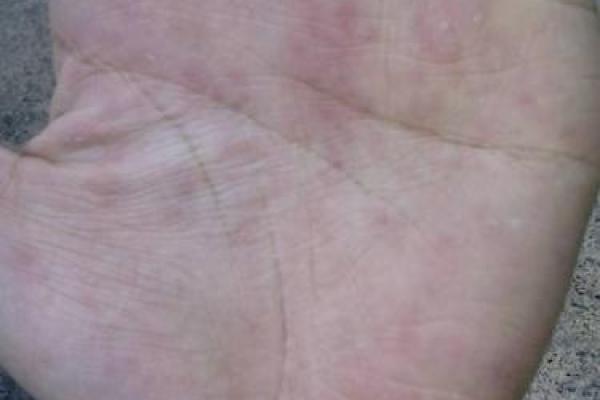 朱砂掌算命,手掌红就是朱砂掌吗? 朱砂掌算命,手掌红就是朱砂掌吗?