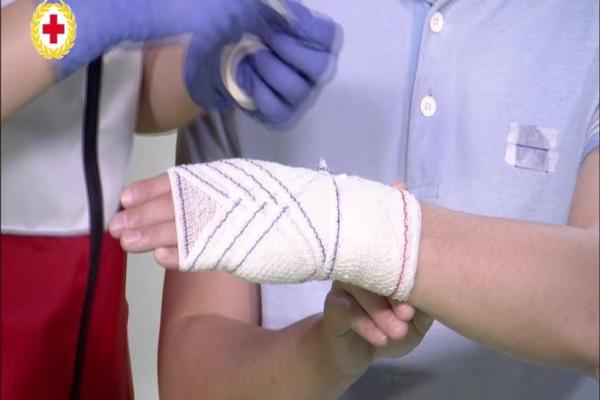 八字包扎法 八字包扎法