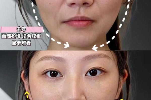 八字纹,八字纹是什么样子图片