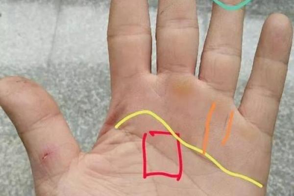 手指内侧长红胎记算命准吗