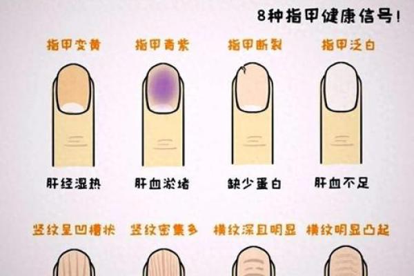 指甲 风水