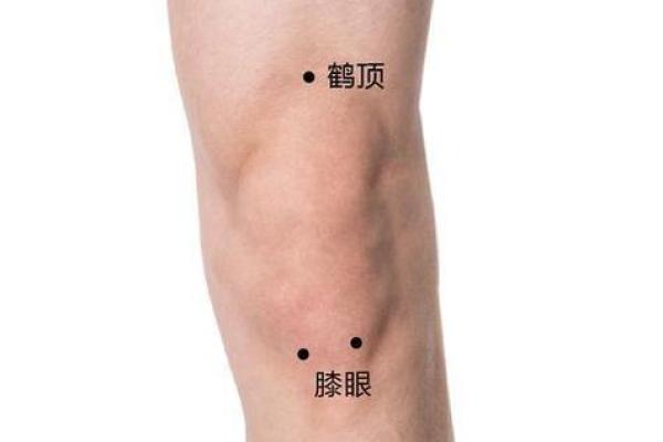 大腿上胎记的位置与算命