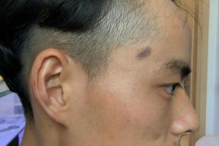 脸的各部位胎记算命详解