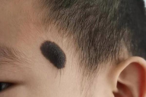 脸上各部位的胎记算命