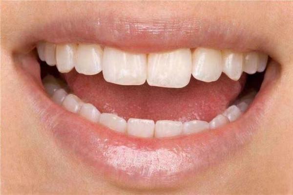 牙齿算命：牙齿的颜色看你的运势