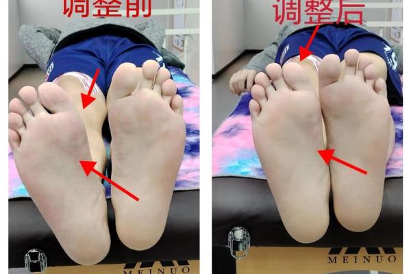 内八字和外八字