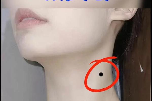 脖子上不同位置胎记算命