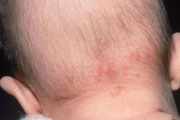 如何通过自己的胎记算命看自己的一生-