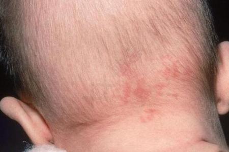 如何通过自己的胎记算命看自己的一生-