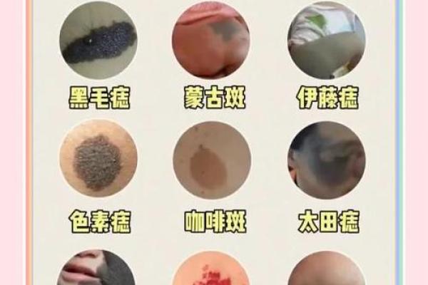 胎记算命图解好坏