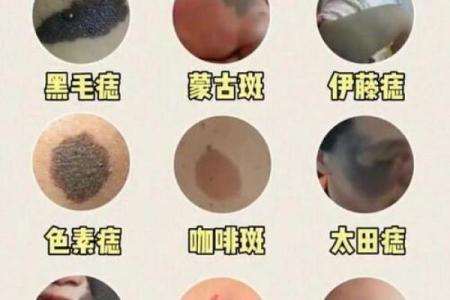 看脸上胎记如何算命