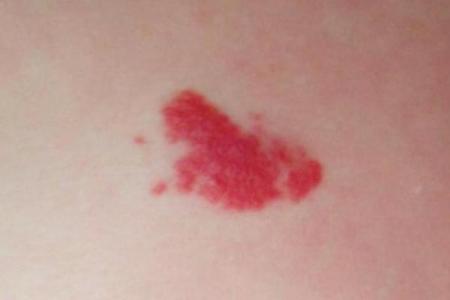 红色的胎记如何看相算命-