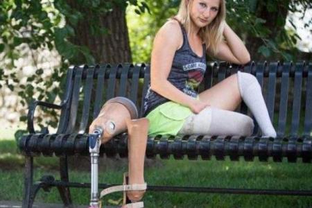 八字肚残疾病原因及预防措施推荐