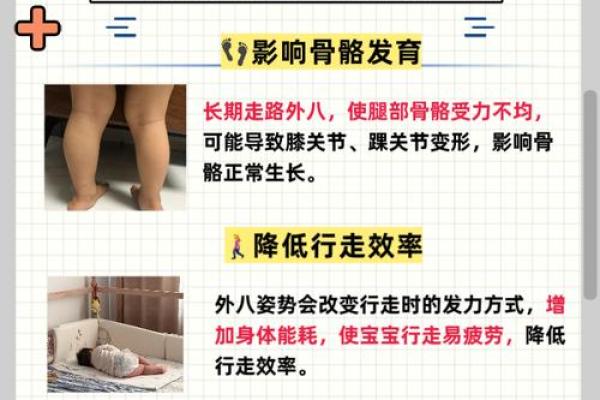 内八字、外八字孩子脚型正常不正常，家长可以这么判断