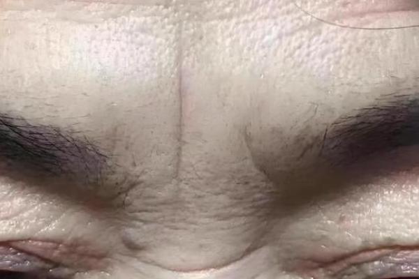 男人印堂八字纹的事业运好吗 男人印堂八字纹的事业运好吗