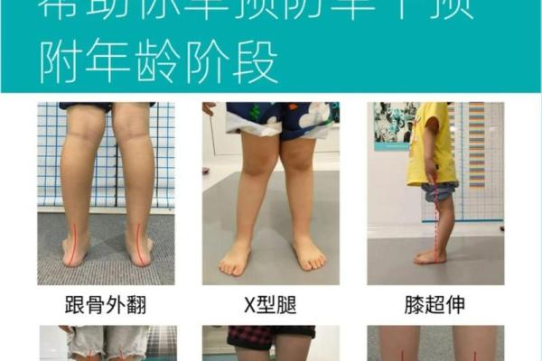 怎样纠正内八字,14岁内八字怎么矫正最快 怎样纠正内八字,14岁内八字怎么矫正最快