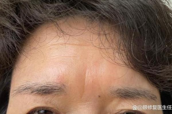 眉心突然出现八字，原因及应对措施全揭秘！